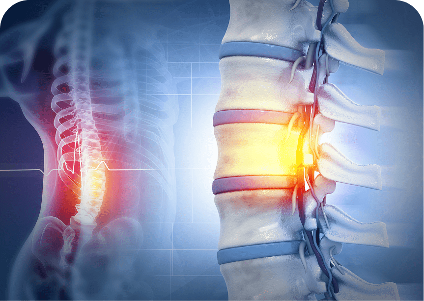 Lumbar spine pain illustration